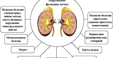 Почки какие болезни бывают