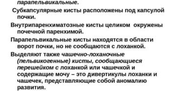 Подкапсульная киста почки что это