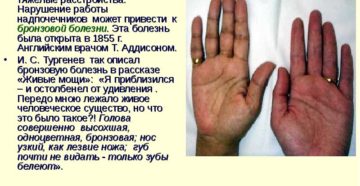Нарушения в работе надпочечников симптомы