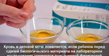 Кровь в моче у ребенка 6 лет