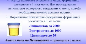 Алгоритм моча по нечипоренко