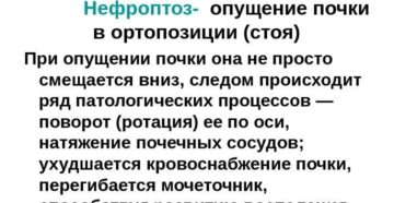 Нефроптоз классификация клиника диагностика лечение