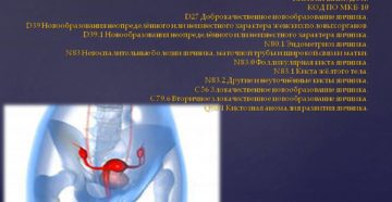 Парауретральная киста по 10 мкб 10