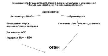 Патогенез почечных отеков