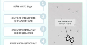 Оксалаты в моче при беременности что это значит