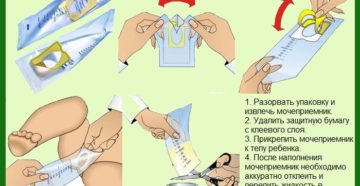 Как собрать мочу у месячного ребенка девочки