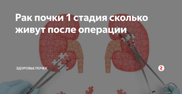 Жизнь после удаления опухоли почки