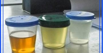 Моча светлая как вода у ребенка