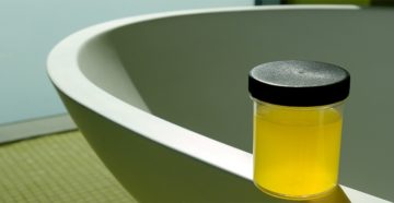 Горячая моча при мочеиспускании у женщин