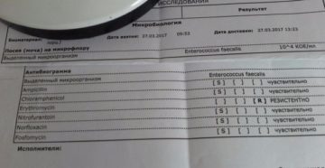 Сколько готовится анализ мочи на бак посев