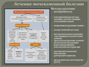 Лечение мочекаменной болезни у человека