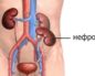 Нефроптоз почки слева что это такое