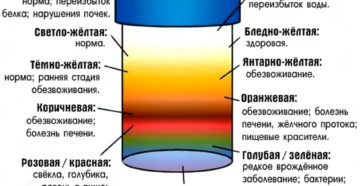 Определить заболевание по цвету мочи