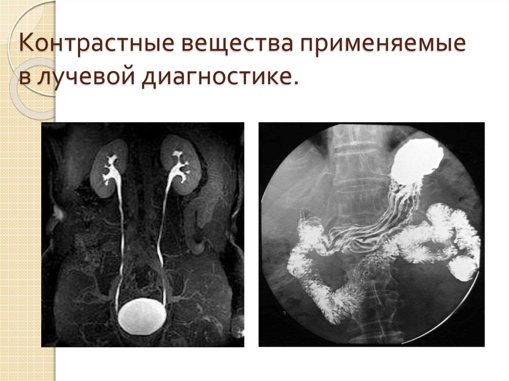 Контрастные вещества в рентгенологии