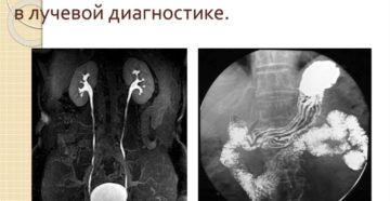 Контрастные вещества в рентгенологии