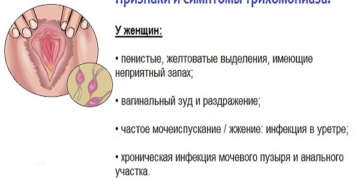 Почему чешется уретра у женщин
