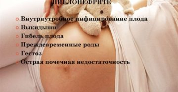 Симптомы пиелонефрита при беременности на ранних сроках