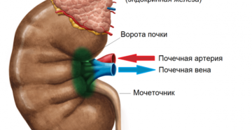 Киста ворот почки