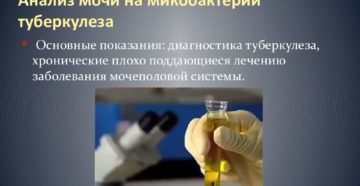 Моча на туберкулез что показывает