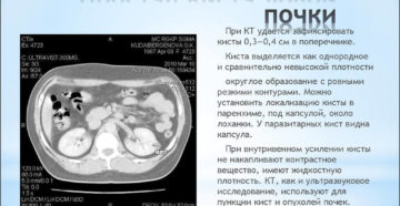Киста на левой почке какое лечение