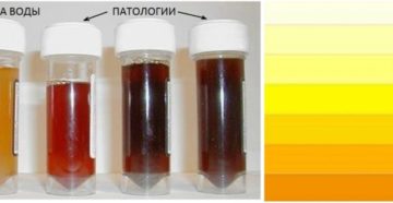 Цвет мочи при цистите у женщин