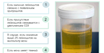 Почему может быть плохая моча