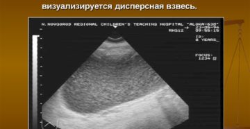 На узи осадок в мочевом пузыре у ребенка