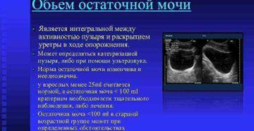Норма остаточная моча в мочевом пузыре у мужчин