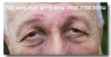 Болит почка мешки под глазами