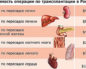 Сколько стоит почка человека в россии