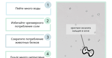 В моче много оксалатов у ребенка