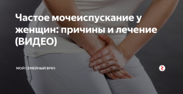 Частые позывы к мочеиспусканию у женщин без боли причины лечение