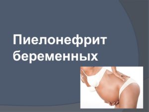 Пиелонефрит беременных презентация