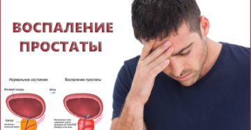 Воспаление у мужчин чем лечить