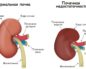 Причины отказа почек у мужчин
