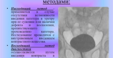Цистография как проводится