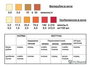 Повышен уробилиноген в моче у ребенка что это