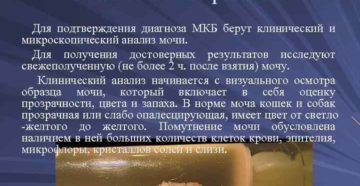 Анализ мочи при мкб