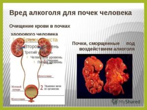 Можно ли пить алкоголь при почечной недостаточности