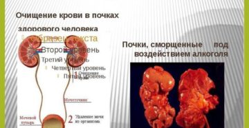 Можно ли пить алкоголь при почечной недостаточности
