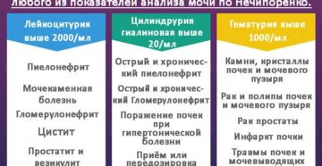 Анализ мочи по нечипоренко при гломерулонефрите