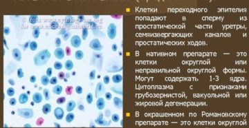 Что значит эпителиальные клетки