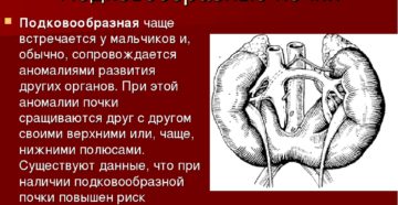 Инвалидность подковообразная почка