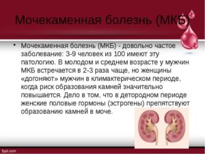 Презентация на тему мочекаменная болезнь