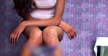 Болят почки и больно ходить в туалет