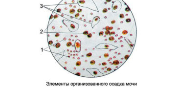 Откуда лейкоциты в моче