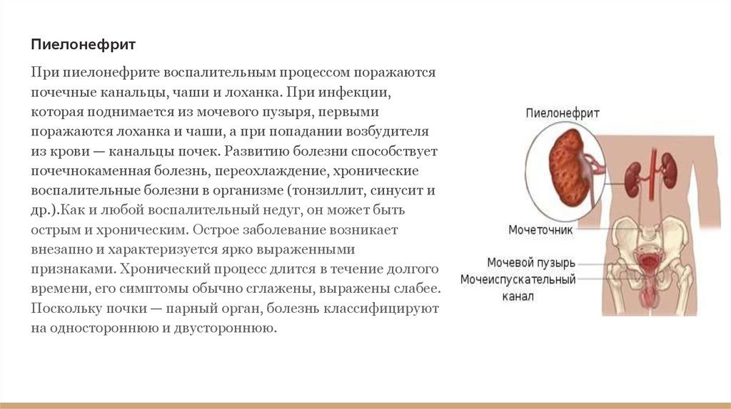 Переохлаждение почек у женщин