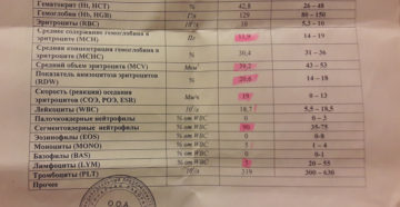 Какого размера должны быть почки у кошки