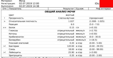 Белок 30 в моче у ребенка