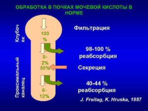 Влияние мочевой кислоты на почки